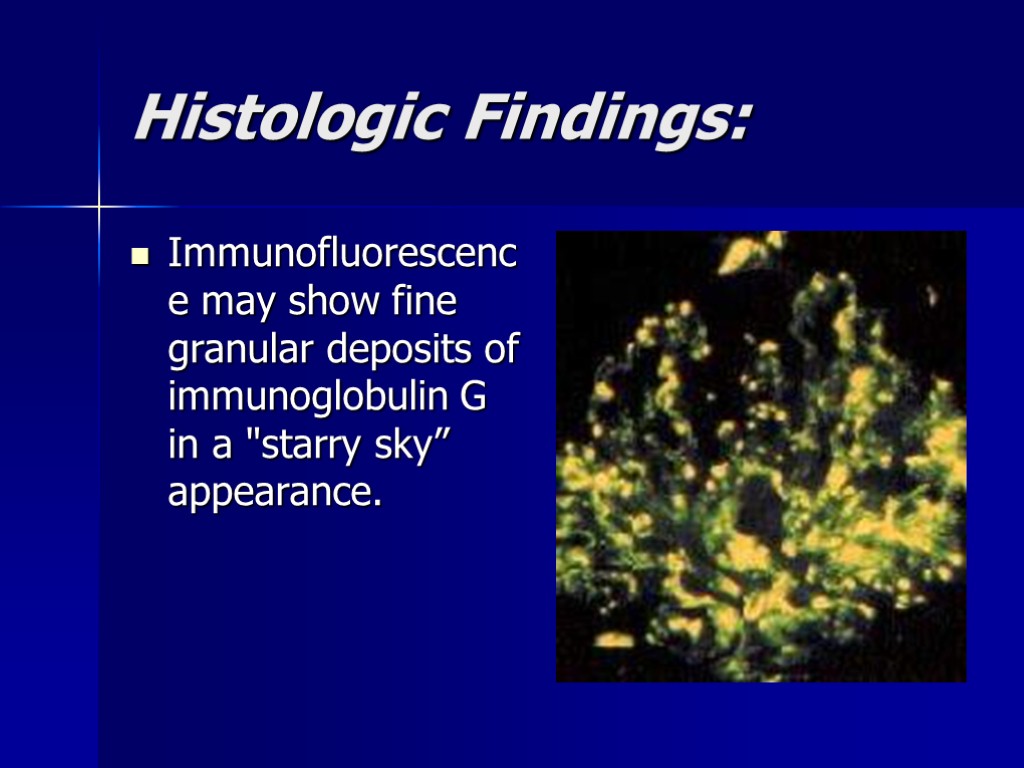 Histologic Findings: Immunofluorescence may show fine granular deposits of immunoglobulin G in a 